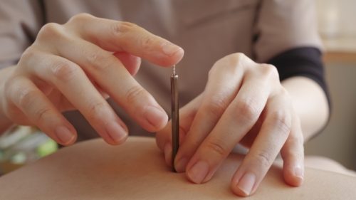 「痛そう」の思い込みを卒業！知っておきたい鍼のホントの心地よさ。